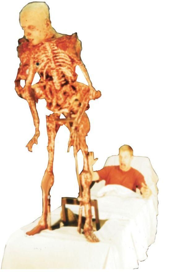 hospital-bed-skelerector-35.png