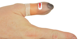 bruised-thumb-40.png