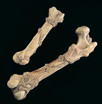 humerus-bone-prop-35.png